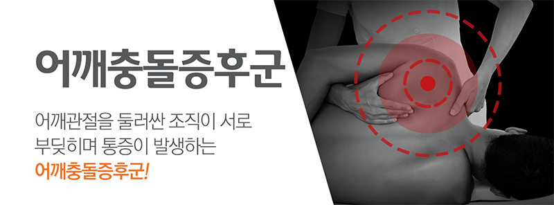 어깨충돌증후군